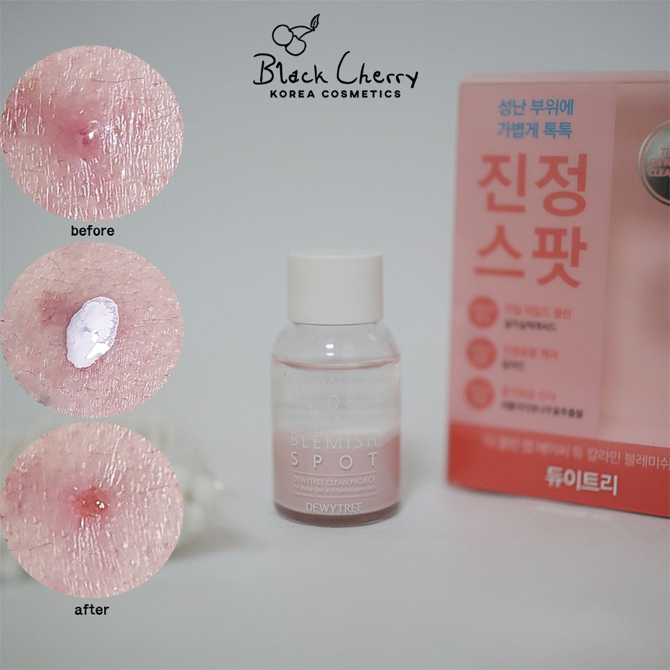 tinh-chat-cham-mun-dewytree-04